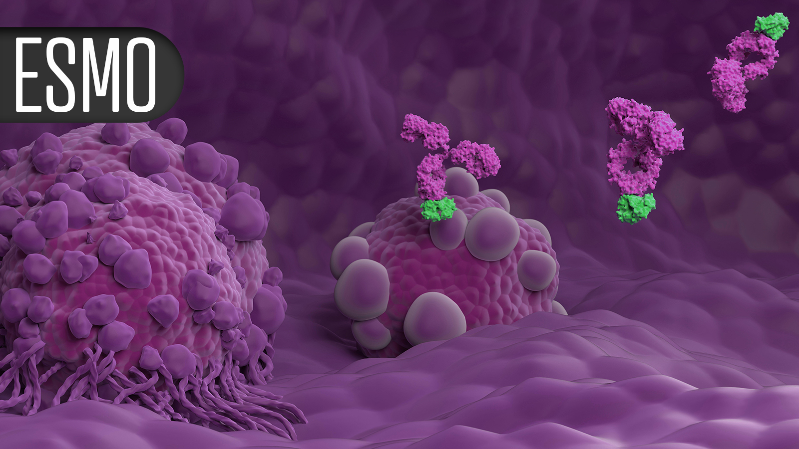 Another 'Practice-Changing' Study in High-Risk Bladder Cancer